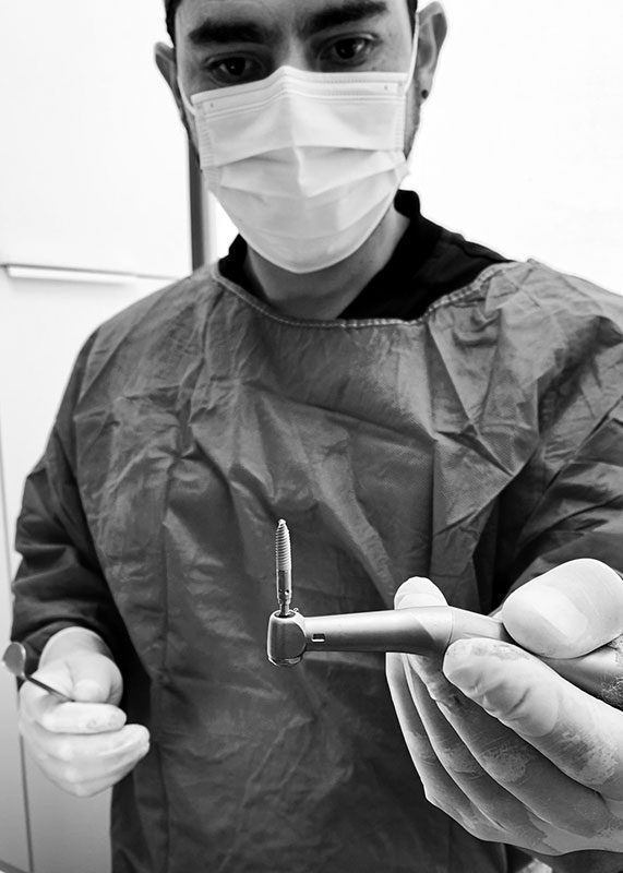 cirugía maxilofacial - Dr. Francisco Butorovic